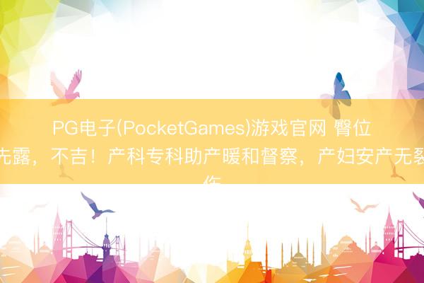 PG电子(PocketGames)游戏官网 臀位足先露，不吉！产科专科助产暖和督察，产妇安产无裂伤